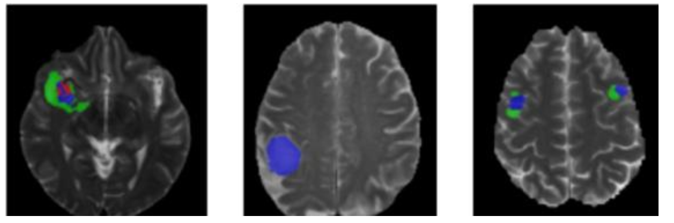 Multi-panel MRI segmentation slices